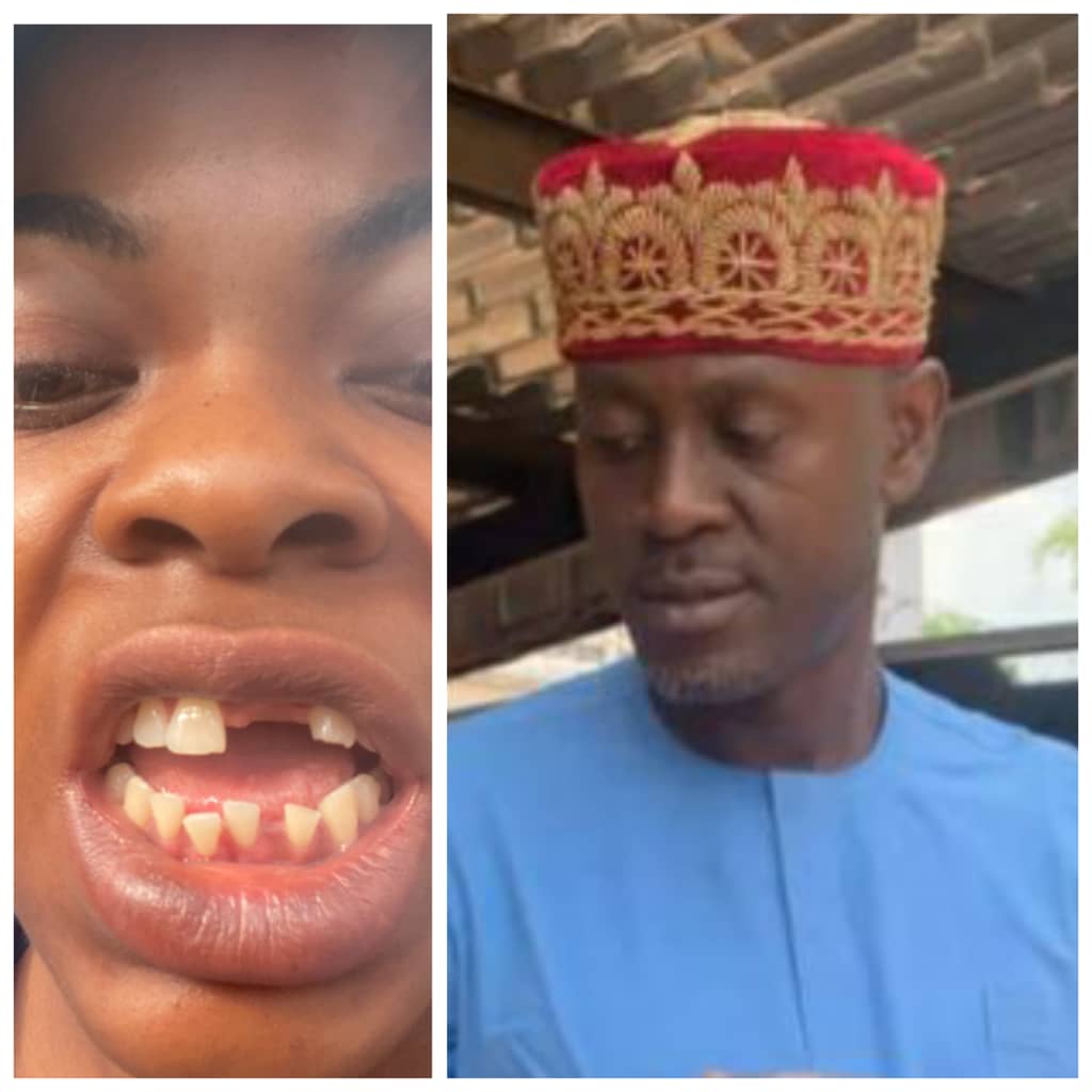 alaba-market-trader-docked-for-knocking-off-wifes-teeth-during-brawl.jpg