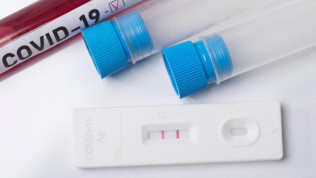 covid-19-resurgence-40-year-old-dies-of-coronavirus-in-chandigarh.jpg