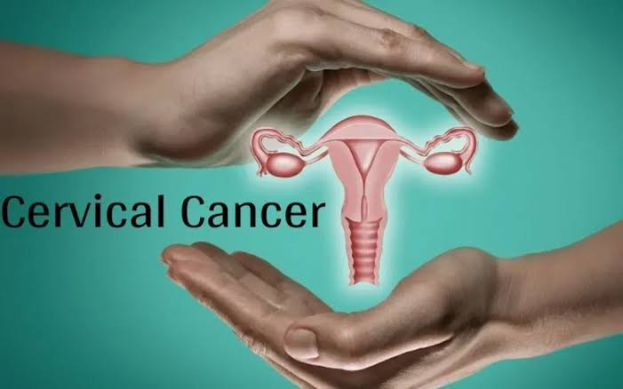 experts-identify-risk-factors-prevention-treatment-of-cervical-cancer.jpg