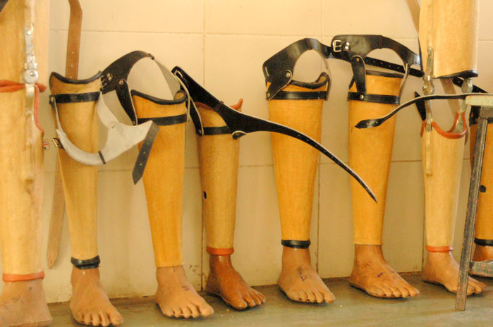 jaipur-foot-rehabilitated-24-lakh-people-with-disabilities-in-india-and-abroad-founder-mehta.jpg