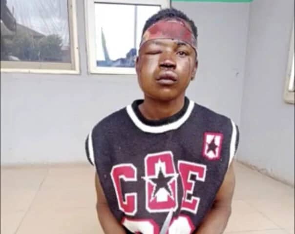 suspected-thief-escapes-lynching-for-attacking-man-who-caught-him.jpg