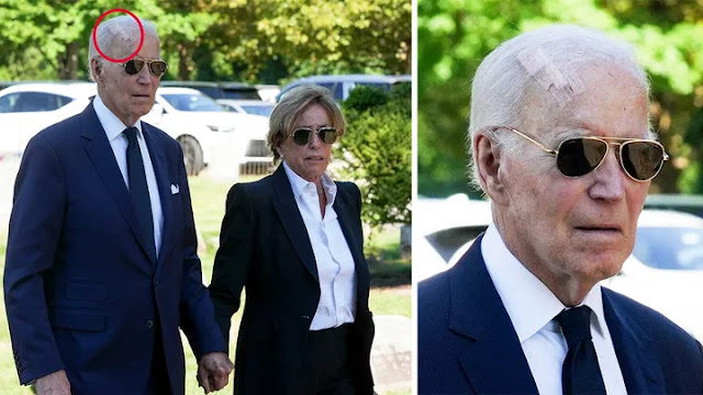 former-president-joe-bidens-health-in-focus-bandage-after-skin-cancer-surgery-sparks-discussion.jpg